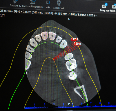 cabinet-dentaire-Panoramic-dsd-technologie