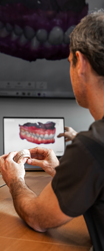 empreinte-optique-Cabinet-Dentaire-Panoramic