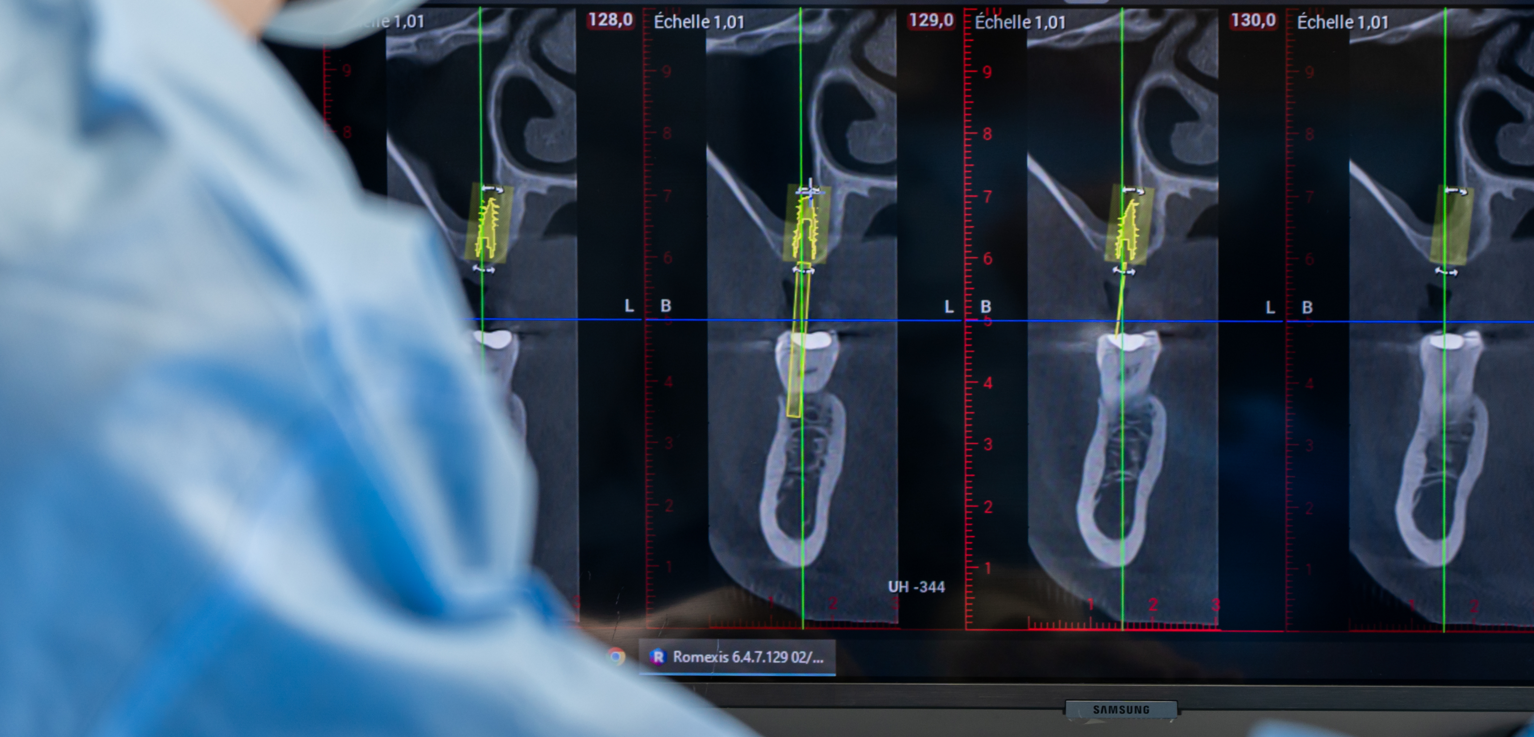 innovation-Cabinet-Dentaire-Panoramic-Saint-Etienne